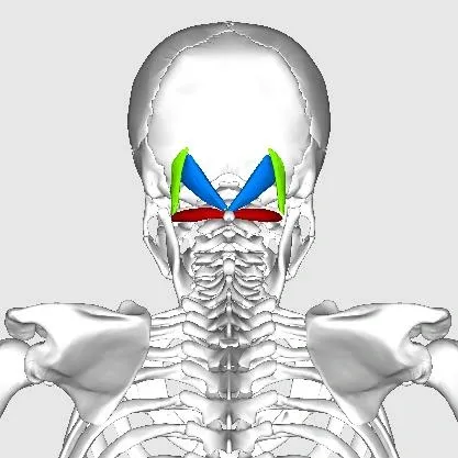 Headache Region